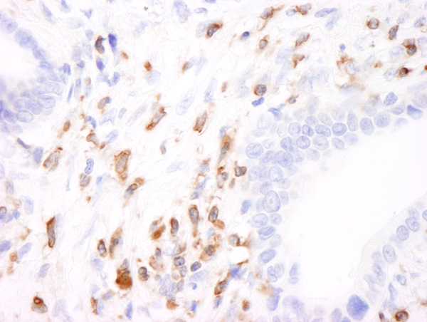 Immunohistochemistry (Formalin/PFA-fixed paraffin-embedded sections) - Anti-Coronin 1a/TACO antibody (AB72212)