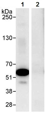 Immunoprecipitation - Anti-Coronin 1a/TACO antibody (AB72212)