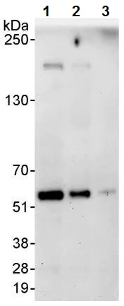 Western blot - Anti-Coronin 1a/TACO antibody (AB72212)