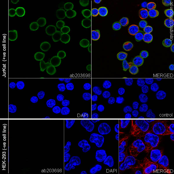 Immunocytochemistry/ Immunofluorescence - Anti-Coronin 1a/TACO antibody [EPR19467-36] (ab203698), expandable thumbnail