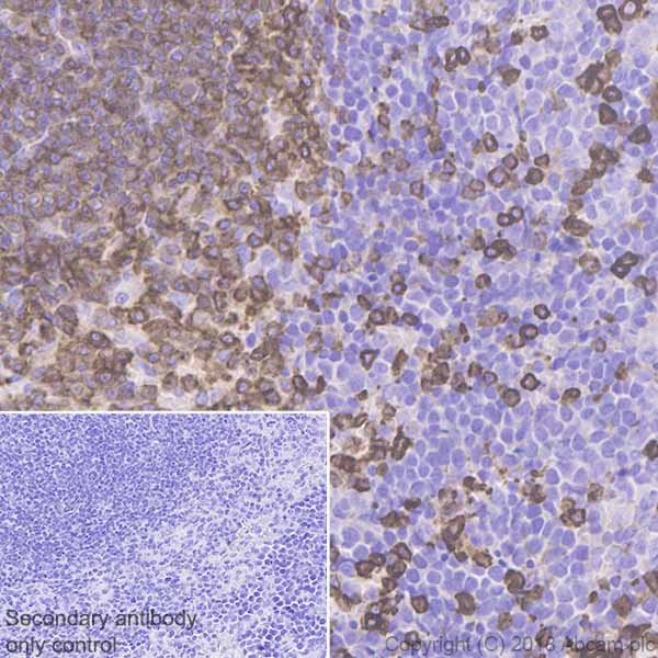 Immunohistochemistry (Formalin/PFA-fixed paraffin-embedded sections) - Anti-Coronin 1a/TACO antibody [EPR19467-36] (AB203698), expandable thumbnail