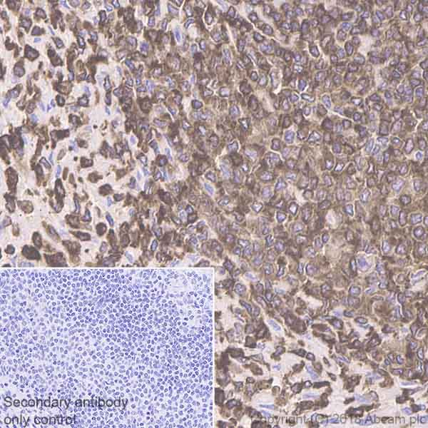 Immunohistochemistry (Formalin/PFA-fixed paraffin-embedded sections) - Anti-Coronin 1a/TACO antibody [EPR19467-36] (AB203698), expandable thumbnail