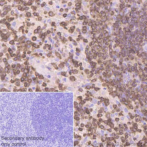 Immunohistochemistry (Formalin/PFA-fixed paraffin-embedded sections) - Anti-Coronin 1a/TACO antibody [EPR19467-36] (AB203698)