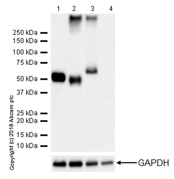 Western blot - Anti-Coronin 1a/TACO antibody [EPR19467-36] (AB203698)
