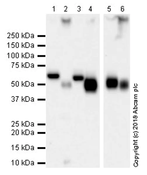 Western blot - Anti-Coronin 1a/TACO antibody [EPR19467-36] (AB203698)