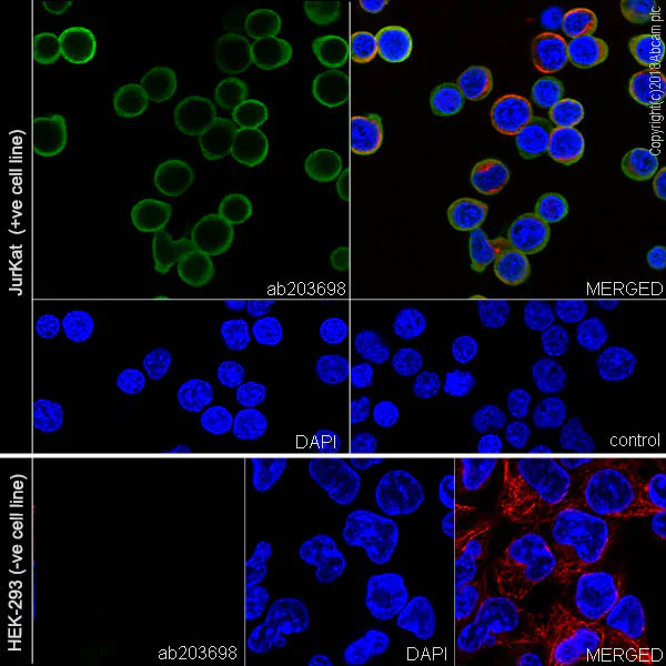Immunocytochemistry/ Immunofluorescence - Anti-Coronin 1a/TACO antibody [EPR19467-36] - BSA and Azide free (AB243562)