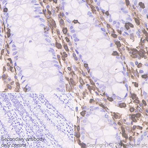 Immunohistochemistry (Formalin/PFA-fixed paraffin-embedded sections) - Anti-Coronin 1a/TACO antibody [EPR19467-36] - BSA and Azide free (AB243562)