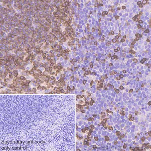 Immunohistochemistry (Formalin/PFA-fixed paraffin-embedded sections) - Anti-Coronin 1a/TACO antibody [EPR19467-36] - BSA and Azide free (AB243562)