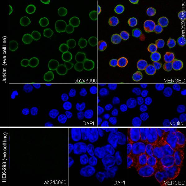 Immunocytochemistry/ Immunofluorescence - Anti-Coronin 1a/TACO antibody [EPR19467-81] (ab243090), expandable thumbnail