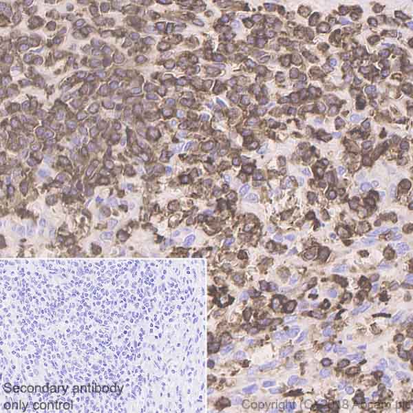 Immunohistochemistry (Formalin/PFA-fixed paraffin-embedded sections) - Anti-Coronin 1a/TACO antibody [EPR19467-81] (AB243090), expandable thumbnail