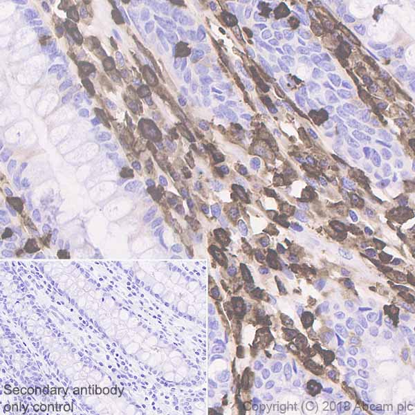 Immunohistochemistry (Formalin/PFA-fixed paraffin-embedded sections) - Anti-Coronin 1a/TACO antibody [EPR19467-81] (AB243090), expandable thumbnail