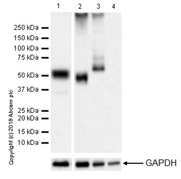 Western blot - Anti-Coronin 1a/TACO antibody [EPR19467-81] (AB243090)