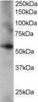 Western blot - Anti-Coronin-1C antibody (AB15719)