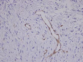 Immunohistochemistry (Formalin/PFA-fixed paraffin-embedded sections) - Anti-Coronin-1C antibody (AB96266), expandable thumbnail
