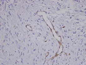 Immunohistochemistry (Formalin/PFA-fixed paraffin-embedded sections) - Anti-Coronin-1C antibody (AB96266)