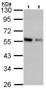 Western blot - Anti-Coronin-1C antibody (AB96266), expandable thumbnail