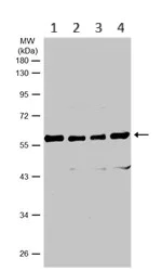 Western blot - Anti-Coronin-1C antibody (AB96266)