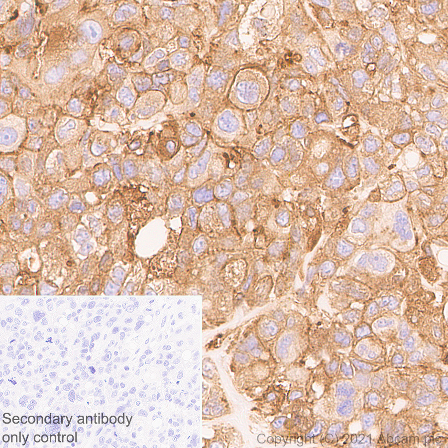 Immunohistochemistry (Formalin/PFA-fixed paraffin-embedded sections) - Anti-Coronin-1C antibody [EPR25365-24] (ab283693), expandable thumbnail