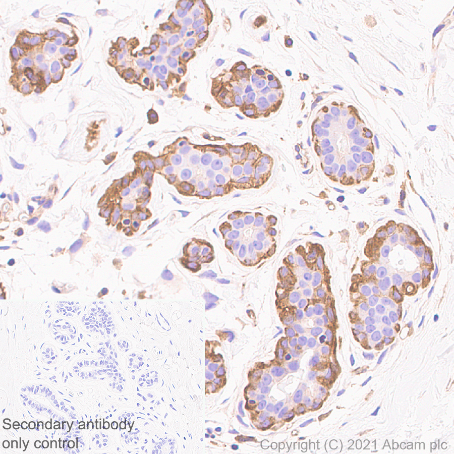 Immunohistochemistry (Formalin/PFA-fixed paraffin-embedded sections) - Anti-Coronin-1C antibody [EPR25365-24] (AB283693), expandable thumbnail