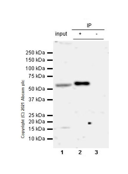 Immunoprecipitation - Anti-Coronin-1C antibody [EPR25365-24] (AB283693), expandable thumbnail