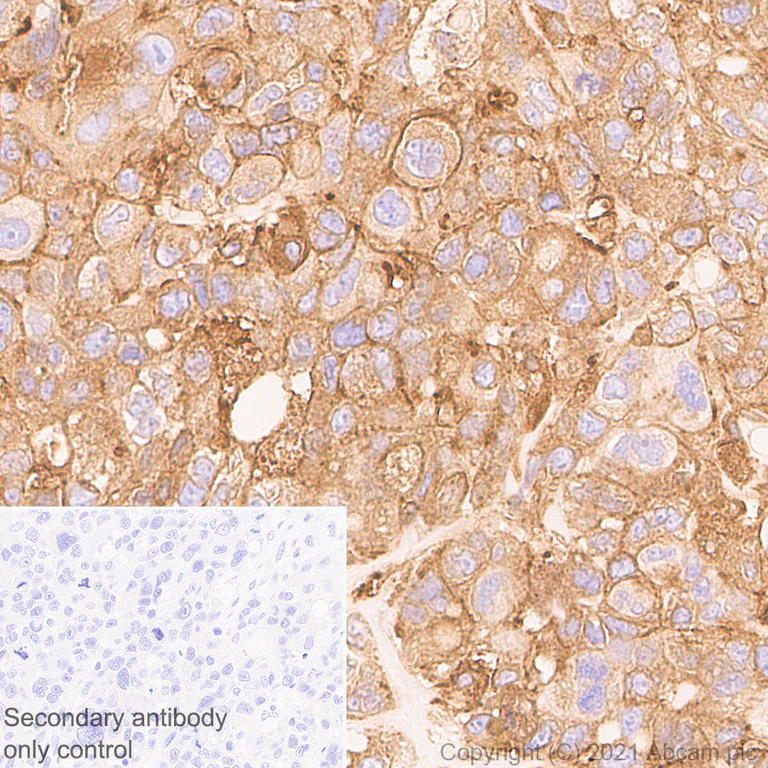 Immunohistochemistry (Formalin/PFA-fixed paraffin-embedded sections) - Anti-Coronin-1C antibody [EPR25365-24] - BSA and Azide free (AB283724)