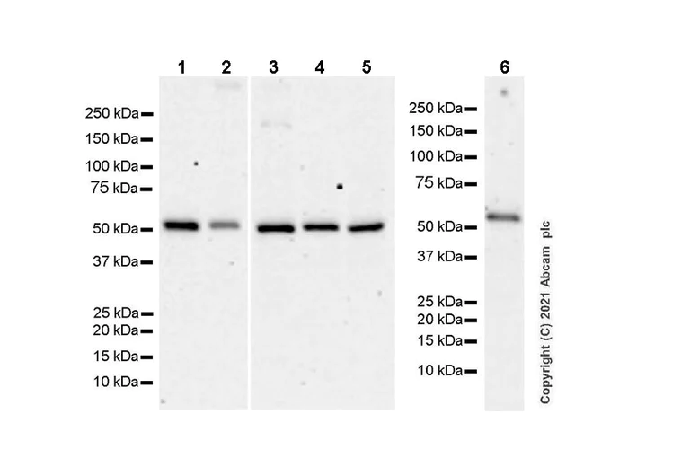 Western blot - Anti-Coronin-1C antibody [EPR25365-24] - BSA and Azide free (AB283724)