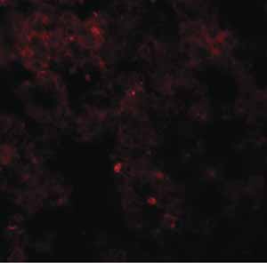 Immunocytochemistry/ Immunofluorescence - Anti-Coronin-7 antibody (AB117446)