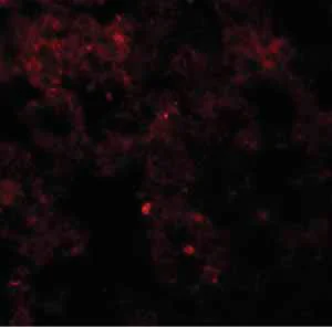 Immunocytochemistry/ Immunofluorescence - Anti-Coronin-7 antibody (AB117446)
