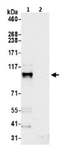 Immunoprecipitation - Anti-Coronin-7 antibody (AB241291)
