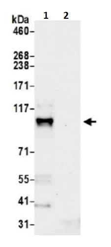 Immunoprecipitation - Anti-Coronin-7 antibody (AB241291)