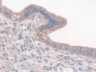 Immunohistochemistry (Formalin/PFA-fixed paraffin-embedded sections) - Anti-Cortactin antibody (AB231620)