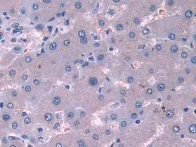 Immunohistochemistry (Formalin/PFA-fixed paraffin-embedded sections) - Anti-Cortactin antibody (AB231620)