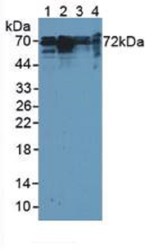 Western blot - Anti-Cortactin antibody (AB231620), expandable thumbnail