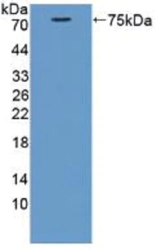 Western blot - Anti-Cortactin antibody (AB231620)