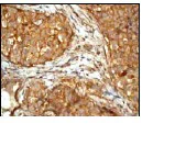 Immunohistochemistry (Formalin/PFA-fixed paraffin-embedded sections) - Anti-Cortactin antibody [EP1922Y] (AB81208)