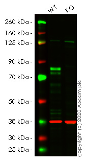 Western blot - Anti-Cortactin antibody [EP1922Y] (AB81208), expandable thumbnail