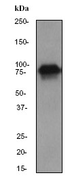Western blot - Anti-Cortactin antibody [EP1922Y] (ab81208), expandable thumbnail