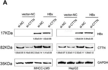 Western blot - Anti-Cortactin antibody [EP1922Y] (AB81208)