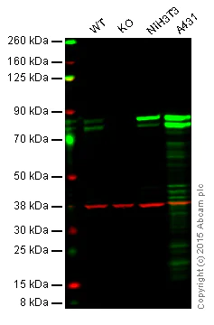 Western blot - Anti-Cortactin antibody [EP1922Y] (AB81208)