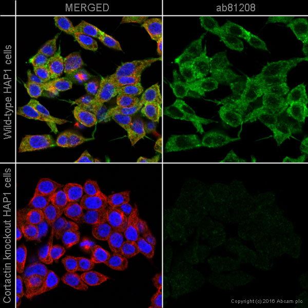 Immunocytochemistry/ Immunofluorescence - Anti-Cortactin antibody [EP1922Y] - BSA and Azide free (AB223125), expandable thumbnail
