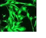 Immunocytochemistry/ Immunofluorescence - Anti-Cortactin antibody [EP1922Y] - BSA and Azide free (AB223125)