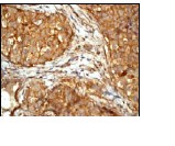 Immunohistochemistry (Formalin/PFA-fixed paraffin-embedded sections) - Anti-Cortactin antibody [EP1922Y] - BSA and Azide free (AB223125), expandable thumbnail