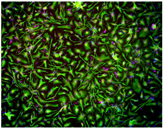 Immunocytochemistry/ Immunofluorescence - Cortical Astrocytes - Human iPSC derived cells (Male, WC-30) (AB315369)