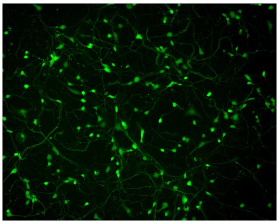 Immunocytochemistry/ Immunofluorescence - Cortical GABAergic Neurons - Human iPSC-derived cells (Male, WC-30) (AB315368)