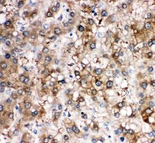 Immunohistochemistry (Formalin/PFA-fixed paraffin-embedded sections) - Anti-Cortisol Binding Globulin antibody - N-terminal (AB191053)