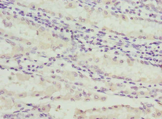 Immunohistochemistry (Formalin/PFA-fixed paraffin-embedded sections) - Anti-COSMC antibody (AB229831)