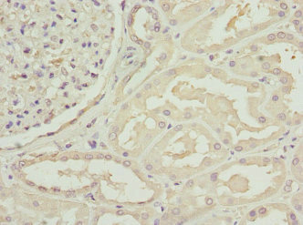 Immunohistochemistry (Formalin/PFA-fixed paraffin-embedded sections) - Anti-COSMC antibody (AB229831)