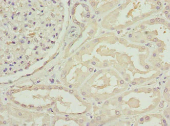 Immunohistochemistry (Formalin/PFA-fixed paraffin-embedded sections) - Anti-COSMC antibody (AB229831)