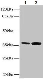 Western blot - Anti-COSMC antibody (AB229831)