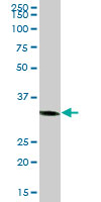 Western blot - Anti-COSMC antibody (AB68310)